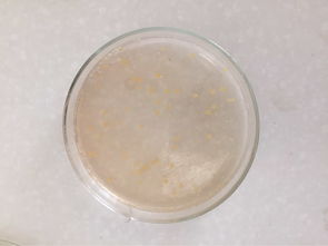 食品微生物檢測中的菌落總數問題 基于PowerDiscuz的技術與實踐探討